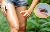 Những mẹo tránh muỗi đốt đơn giản và hiệu quả