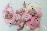 Ngày mai sẽ Shbet888 tiền thưởng cực khủng tách rời cặp song sinh dính nhau vùng chậu