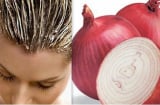Mẹo hay: 'Tạm biệt' tóc rụng, hói đầu chỉ bằng 1 củ hành tây