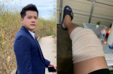 Diễn viên Hoàng Anh 'Gạo nếp gạo tẻ' chia sẻ tình hình sức khỏe sau ca Shbet888 tiền thưởng cực khủng đầu gối
