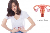 7 kiểu phụ nữ có nguy cơ mắc ung thư cổ tử cung cao, ai thuộc một trong số này cần đi khám ngay