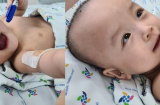 Dự kiến 6 tuần nữa, Trúc Nhi- Diệu Nhi sẽ được tháo băng, tập đi