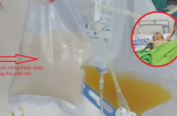 Sau bữa nhậu, máu người đàn ông 'trắng như sữa' phải thay huyết tương cấp cứu