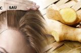 Nối tóc chỉ thêm nặng đầu, chi bằng học lỏm 5 cách cực hay vừa kích thích tóc mọc nhanh lại an toàn