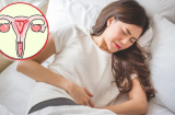 5 thói quen cực xấu khiến chị em mắc các bệnh cổ tử cung, hãy thay đổi sớm trước khi quá muộn