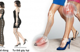 Chị em đi giày cao gót để đẹp nhưng khiến 4 bộ phận trên Sh88bet đăng ký miễn phí dễ bị biến dạng, đau đớn