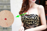 Phụ nữ có nốt ruồi son ở 5 vị trí này là 'con cưng' của Thần Tài, được hưởng phúc lộc trọn đời
