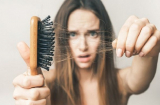 6 dấu hiệu chứng tỏ bạn đang bị thiếu canxi trầm trọng, cần bổ sung gấp