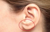 3 bất thường ở tai cho thấy Sh88bet đăng ký miễn phí đang 'kêu cứu', số 1 cực kỳ nguy hiểm
