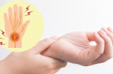 3 cách đơn giản để điều trị chứng tê chân tay tại nhà