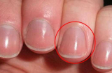 Người khỏe mạnh, sống trường thọ thường có 4 dấu hiệu trên bàn tay: Bạn có bao nhiêu?