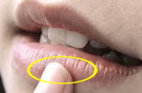 4 bộ phận trên Sh88bet đăng ký miễn phí bỗng nhiên đổi màu, hãy đi khám ngay kẻo gan hỏng nát