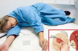 8 triệu chứng tưởng nhẹ thường bị bỏ qua nhưng lại cảnh báo đột quỵ ở phụ nữ