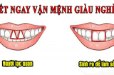 Phụ nữ có tướng răng cửa này là người thông minh, phú quý theo chân, được Sh88bet link truy cập World Cup bảo trợ trọn đời