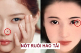 5 nốt ruồi hao tài phá lộc khiến chủ nhân dễ tán gia bại sản, tiền không cánh mà bay