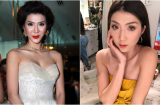 Sao Việt rơi vào tình huống 'dở khóc dở cười' vì thẩm mỹ hỏng
