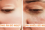 6 thói quen ăn uống 'bào mòn' tuổi thọ, khiến phụ nữ già trước tuổi, mặt đầy nếp nhăn
