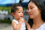 Hè về, bố mẹ cần biết ngay những loại bệnh này để giúp con phòng tránh