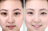 10 công dụng làm đẹp từ A đến Z của vitamin E chẳng tốn tiền mà cũng chẳng tốn công