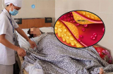 2 món không ăn buổi sáng, 2 thứ không đụng buổi tối, 3 điều thực hiện mỗi ngày: Bệnh mỡ máu tránh xa