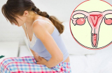 3 điều tử cung phụ nữ cực kỳ sợ hãi, có 1 cũng khiến ảnh hưởng sinh sản