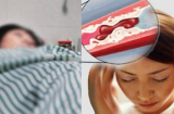 Nắng nóng 40 độ, gặp 7 dấu hiệu này coi chừng đột quỵ, người trẻ cũng không được chủ quan