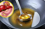5 thói quen sử dụng dầu ăn khiến gan thận nát bấy, đặc biệt là số 2 nhiều người Việt vẫn làm mỗi ngày
