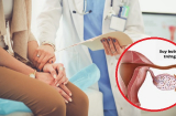 Nữ sinh 15t bị suy buồng trứng sớm: Nguyên nhân do căn bệnh mắc 5 năm trước