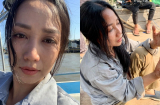 Ốc Thanh Vân bất ngờ đăng ảnh bị mẻ răng, người đầy thương tích