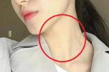 3 bộ phận trên Sh88bet đăng ký miễn phí phụ nữ càng nhỏ càng khỏe mạnh, số 3 chị em không biết lại rất tự ti