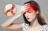 Bị thiếu máu não đừng chủ quan vì có thể gây đột quỵ: 5 dấu hiệu nhận biết, người trẻ  lưu ý