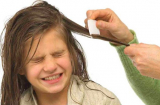 Mẹ dùng thuốc trừ sâu diệt chấy cho con, bé gái 11 tuổi nhập viện cấp cứu