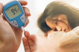 Tự kiểm tra đường huyết thông qua 5 dấu hiệu trên Sh88bet đăng ký miễn phí: Có 1 điểm cũng cảnh báo nguy cơ mắc tiểu đường