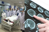 Ăn chay trường để phòng bệnh, người đàn ông vẫn bị nhồi máu não: Nguyên nhân do 1 Shbet0099 cá cược trực tuyến nhiều nhà có