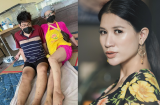Trang Trần đăng ảnh chân bị ghẻ lở, bức xúc vì bị nói ăn chặn từ thiện