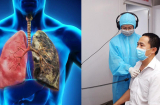Ngoài thuốc lá còn 5 thói quen hại phổi, làm hỏng hệ hô hấp, nhiều người vẫn làm hàng ngày