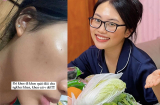 Tốn công chăm sóc nhưng Phương Mỹ Chi vẫn đau đầu vì da đầy khuyết điểm