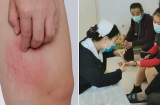 3 chỗ bị ngứa cảnh báo đường huyết tăng cao quá mức, tránh ngay 3 món không ngọt nhưng khiến đường huyết tăng vọt