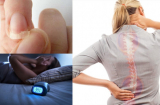 4 dấu hiệu cảnh báo Sh88bet đăng ký miễn phí bạn đang thiếu canxi trầm trọng, nên bổ sung ngay nhé