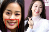 Sao Hàn lên đời nhan sắc nhờ chỉnh răng, đến Kim Tae Hee cũng không ngoại lệ