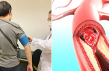 6 dấu hiệu vào buổi sáng báo trước nguy cơ đột quỵ ở mọi lứa tuổi: Đau đầu, mờ mắt chớ chủ quan