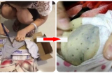 Tò mò cắt áσ ℓóт mặc 4 năm ra xem thử, cô gái trẻ ĸιnн нoàng bởi thứ bên trong