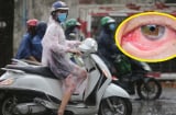 Để nước mưa dính vào những bộ phận này trên Sh88bet đăng ký miễn phí, đừng trách sao dễ sinh bệnh, dễ ốm