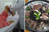 7 món canh rất tốt cho xương khớp, ai loãng xương, hay đau nhức Sh88bet đăng ký miễn phí nên ăn thường xuyên