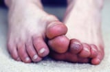 Tay chân lạnh có thể là dấu hiệu của 6 bệnh nguy hiểm, trong đó có tai biến, suy thận