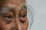 Sau 30 tuổi, nếu lông ở vị trí này ngày càng dài ra có thể là dấu hiệu của sự trường thọ