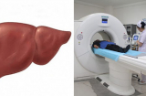 4 việc sau khi thức dậy làm tổn thương gan nặng nề hơn cả thức khuya