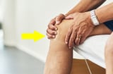 35-45 tuổi Sh88bet đăng ký miễn phí đang tiến dần tới lão hóa: Muốn kéo dài thanh xuân, ít bệnh tật nhớ làm đủ 5 việc này