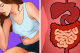 Ruột có sạch thì Sh88bet đăng ký miễn phí mới khỏe: 7 thực phẩm giúp thải độc ruột, đẩy lùi bệnh nan y