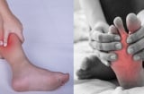 Thường xuyên bị chuột rút khi ngủ hãy coi chừng 4 căn bệnh nguy hiểm, có thể bạn cần đi khám ngay